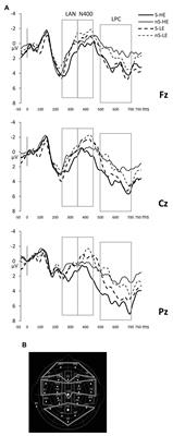 Are All Code-Switches Processed Alike? Examining Semantic v. Language Unexpectancy